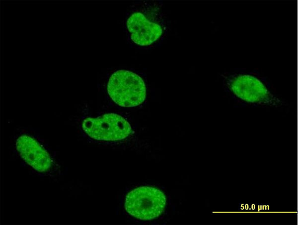 CRKRS Antibody in Immunocytochemistry (ICC/IF)