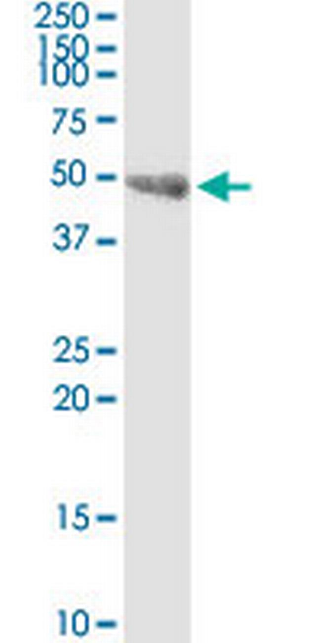 INPP5K Antibody in Western Blot (WB)