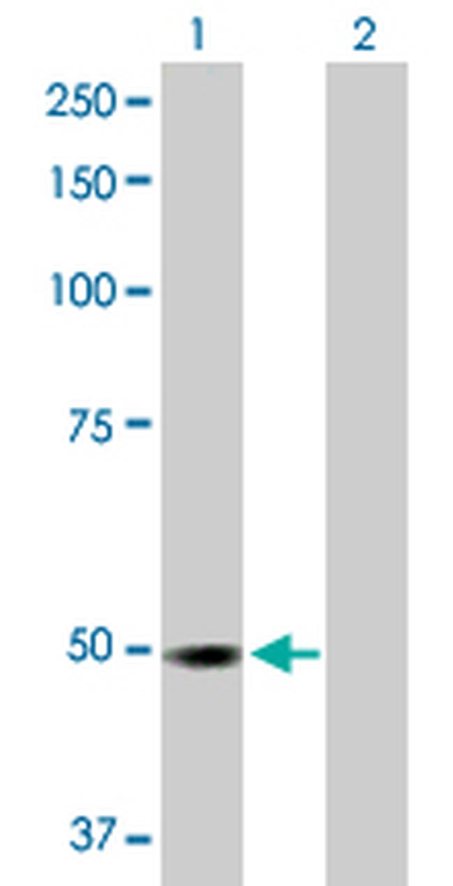 RP6-213H19.1 Antibody in Western Blot (WB)