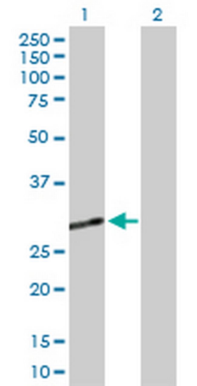 CECR1 Antibody in Western Blot (WB)