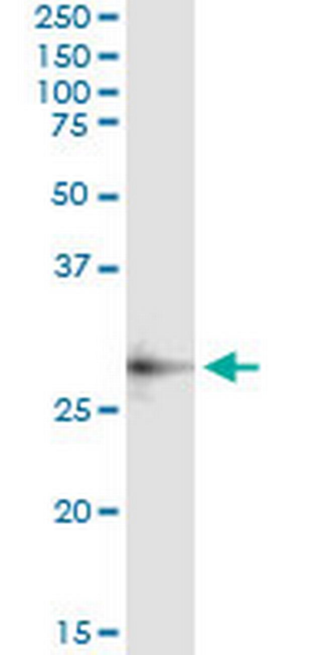 CECR1 Antibody in Immunoprecipitation (IP)