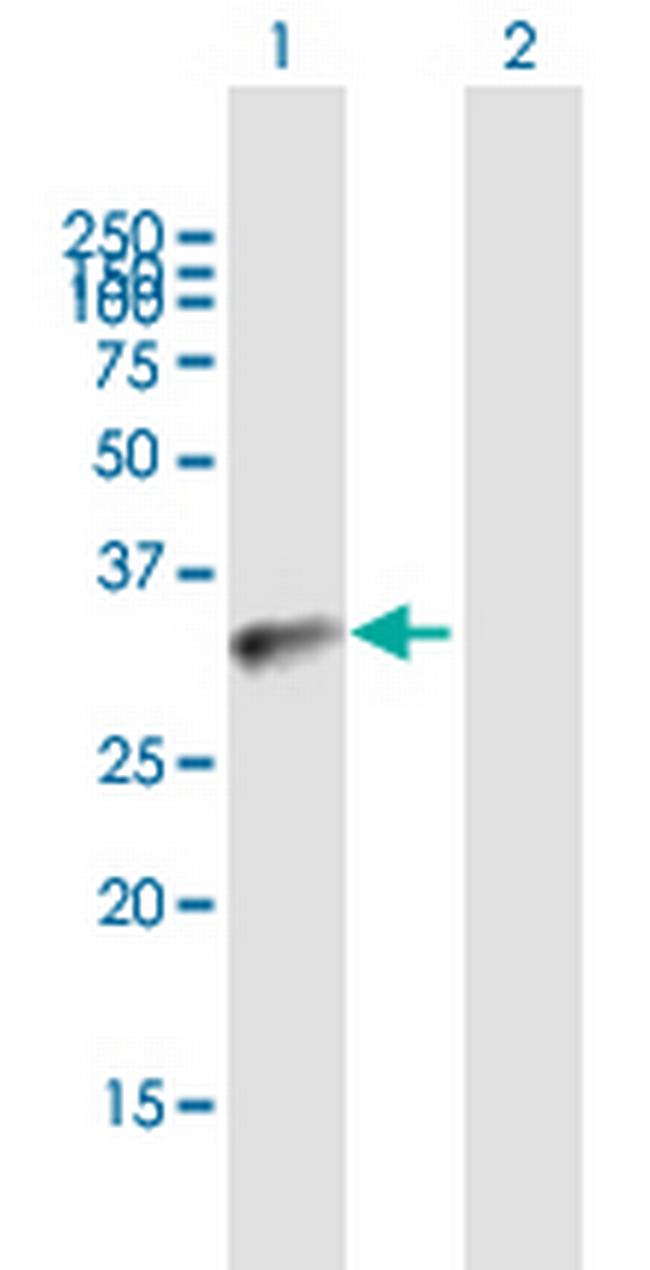 BCL11A Antibody in Western Blot (WB)