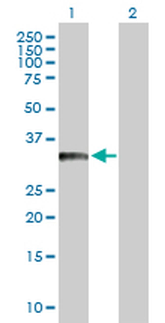 BCL11A Antibody in Western Blot (WB)