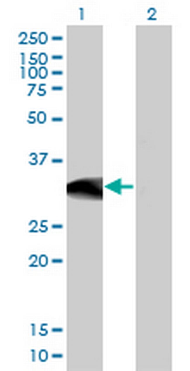 BCL11A Antibody in Western Blot (WB)