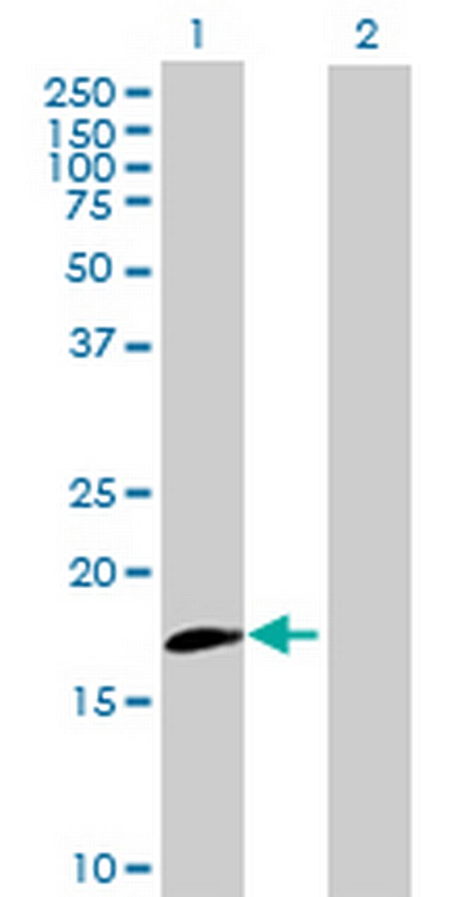 IL20RB Antibody in Western Blot (WB)