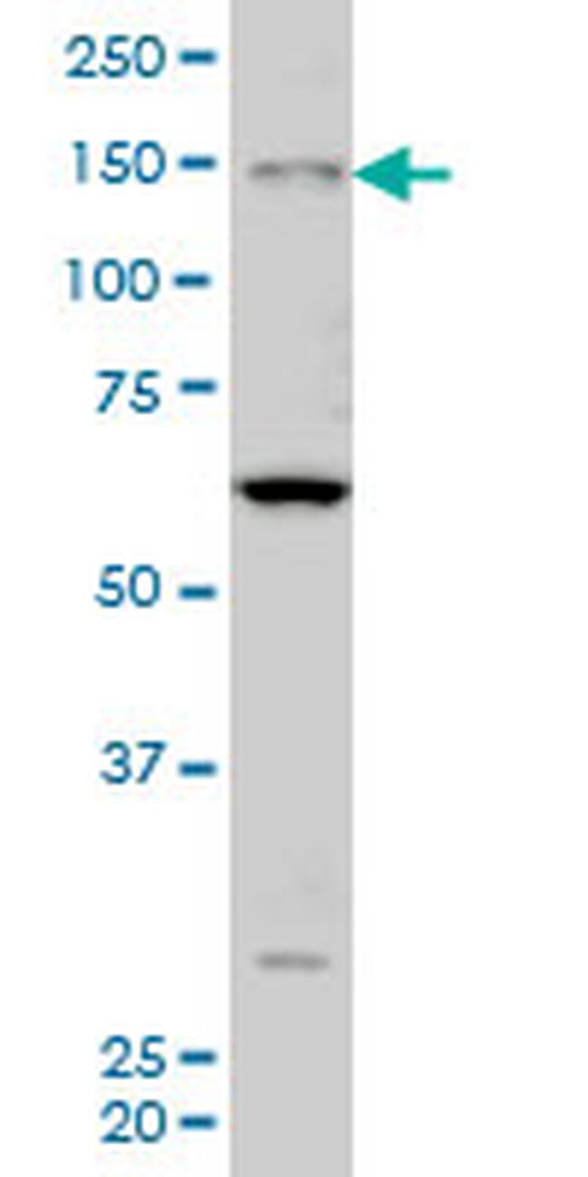 MYO3A Antibody in Western Blot (WB)