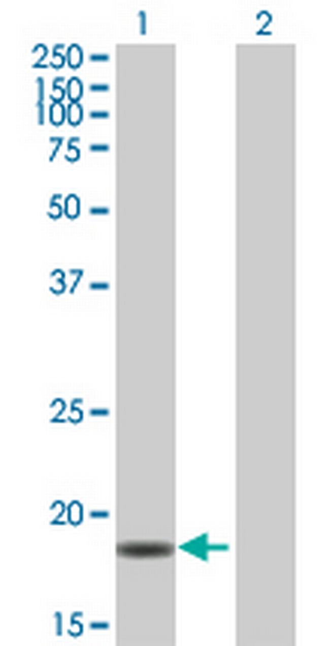 PPIL3 Antibody in Western Blot (WB)