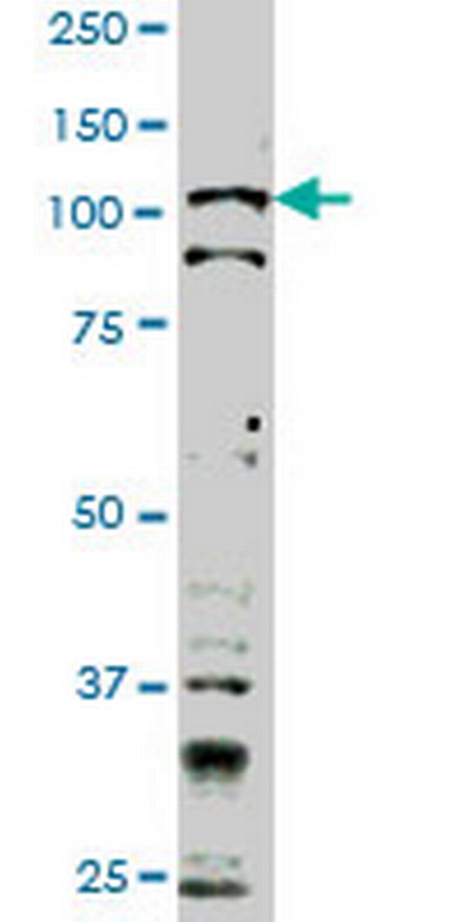 TLR9 Antibody in Western Blot (WB)