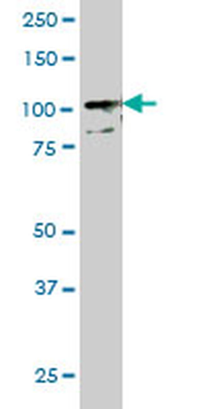 TLR9 Antibody in Western Blot (WB)