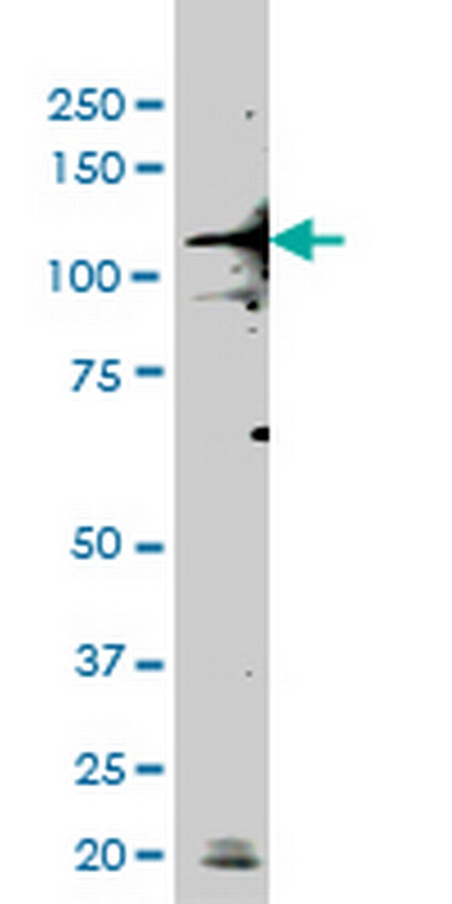 TLR9 Antibody in Western Blot (WB)