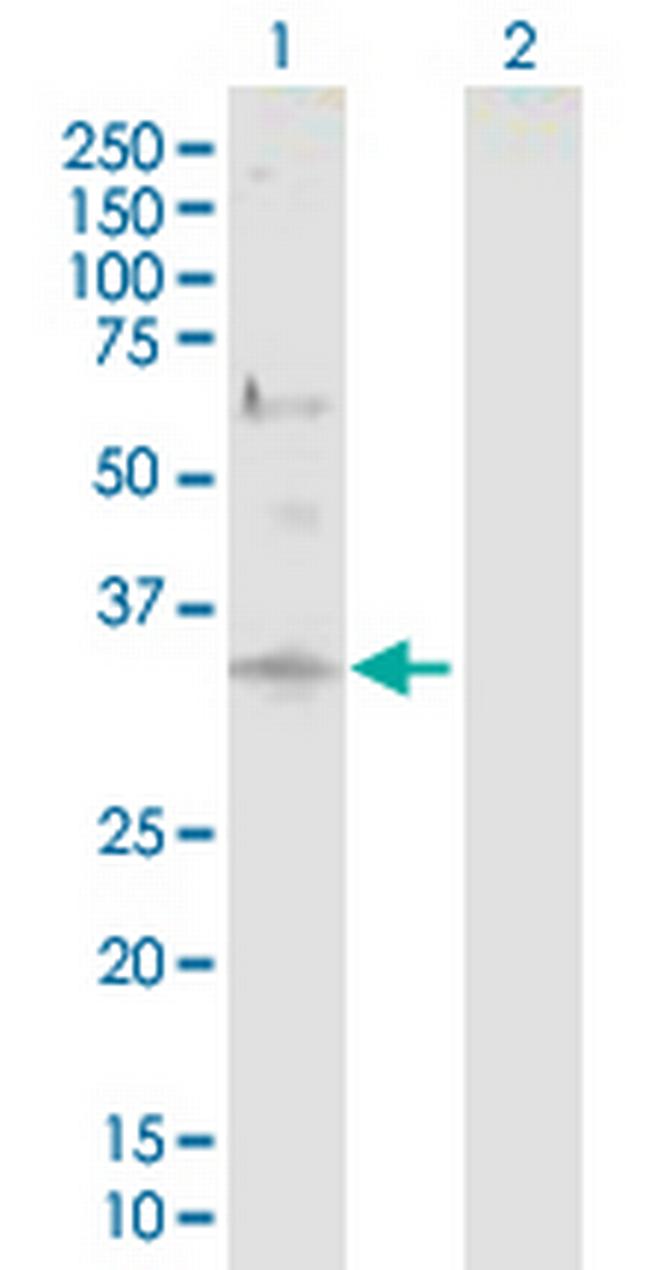 DCUN1D1 Antibody in Western Blot (WB)
