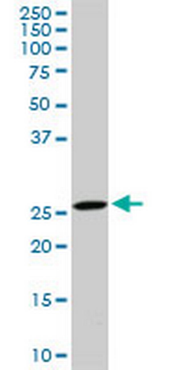 DCUN1D1 Antibody in Western Blot (WB)