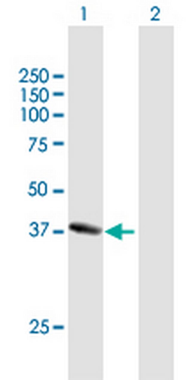 NANS Antibody in Western Blot (WB)