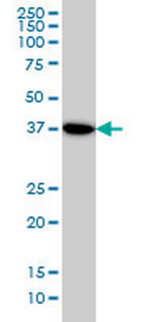 NANS Antibody in Western Blot (WB)