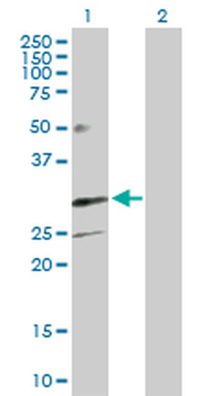 TREM1 Antibody in Western Blot (WB)