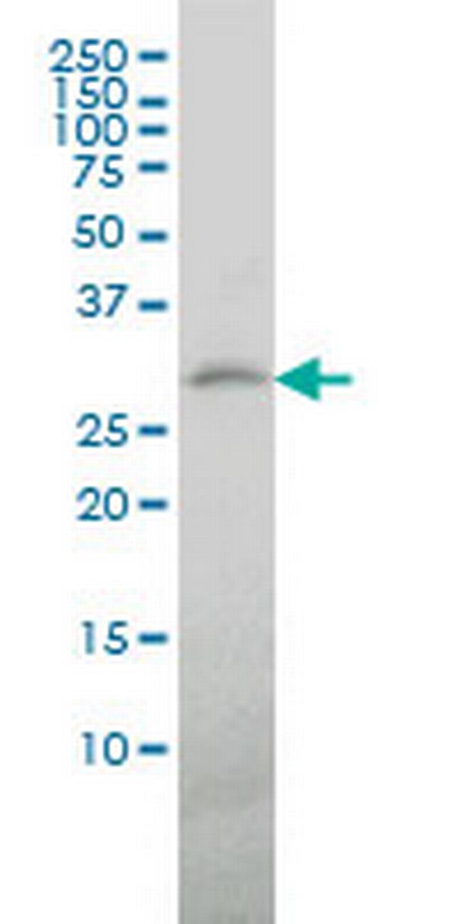 TREM1 Antibody in Western Blot (WB)