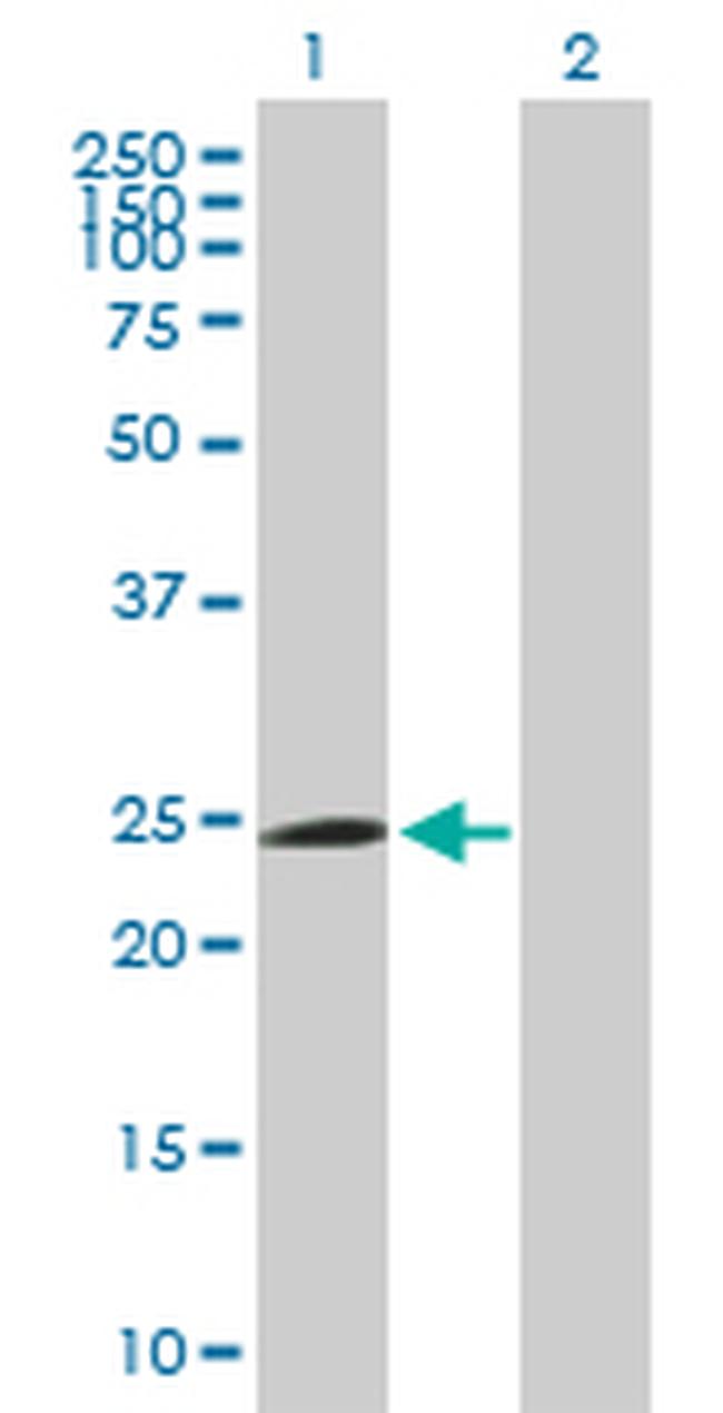 FBXO42 Antibody in Western Blot (WB)