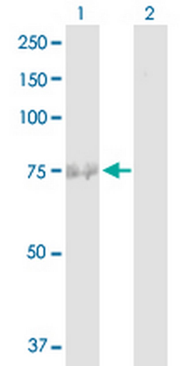 FBXO42 Antibody in Western Blot (WB)