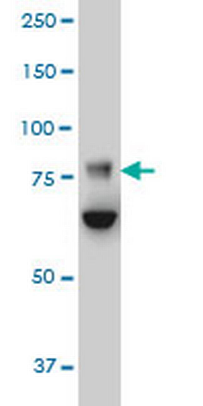 FBXO42 Antibody in Western Blot (WB)