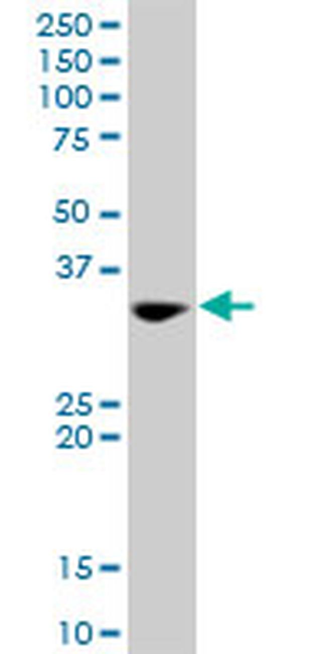 TOLLIP Antibody in Western Blot (WB)