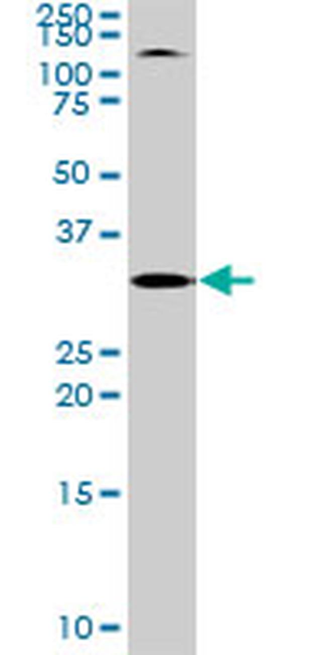 TOLLIP Antibody in Western Blot (WB)