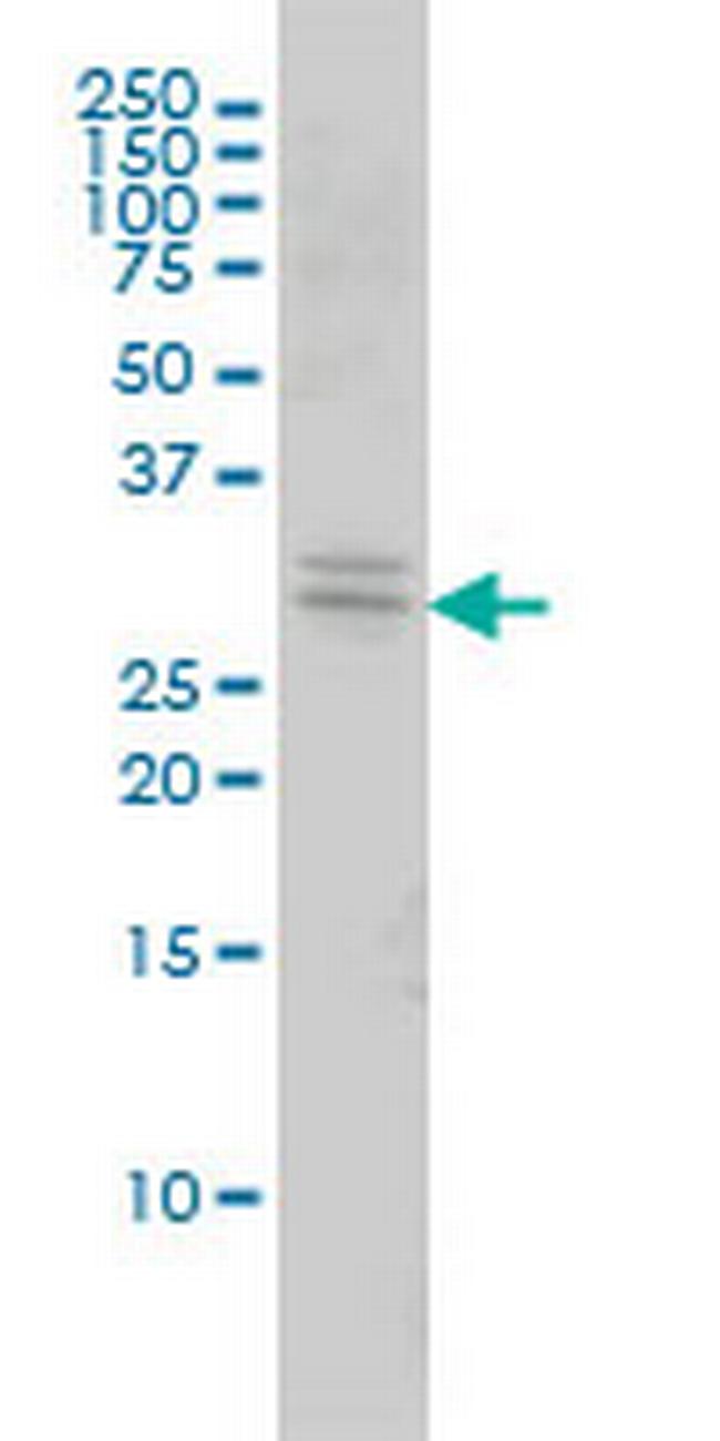 TOLLIP Antibody in Western Blot (WB)