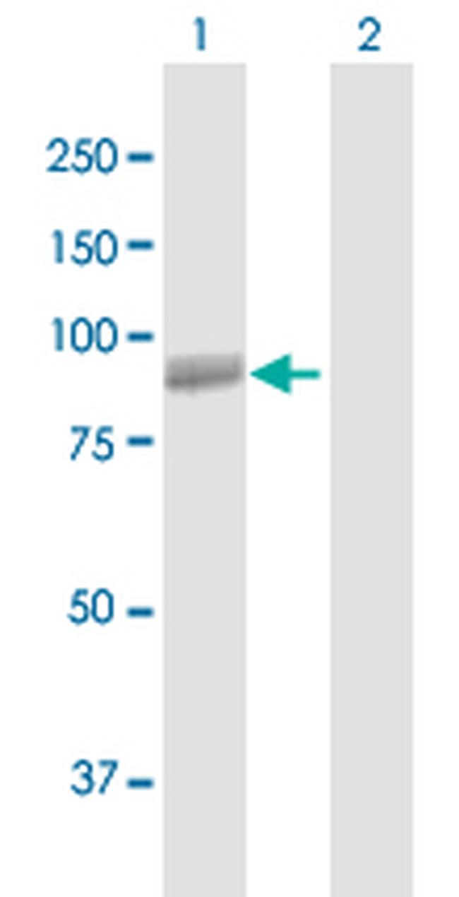 CHPF2 Antibody in Western Blot (WB)