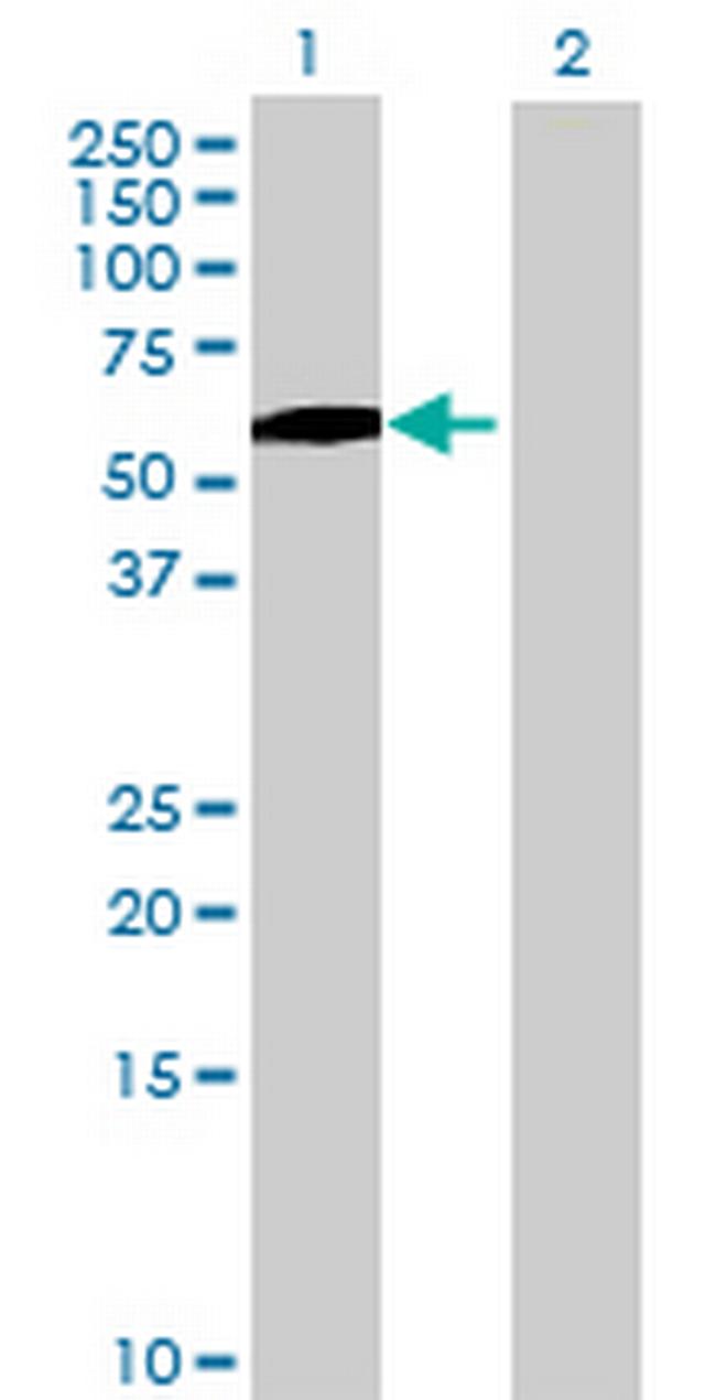 CPVL Antibody in Western Blot (WB)