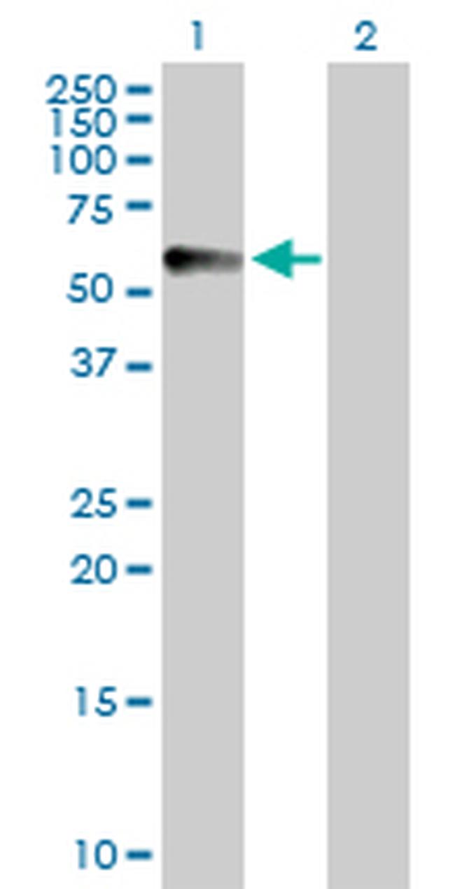 CPVL Antibody in Western Blot (WB)