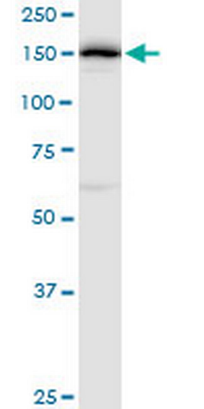 DHX29 Antibody in Western Blot (WB)