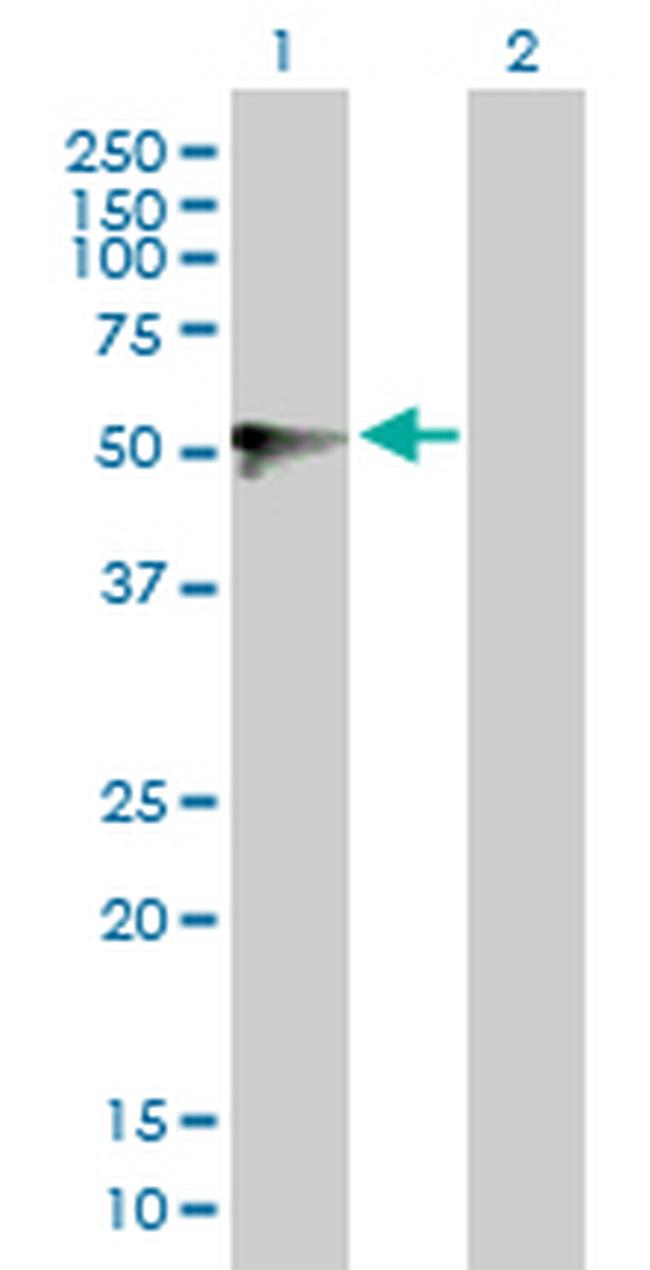 UGT1A9 Antibody in Western Blot (WB)