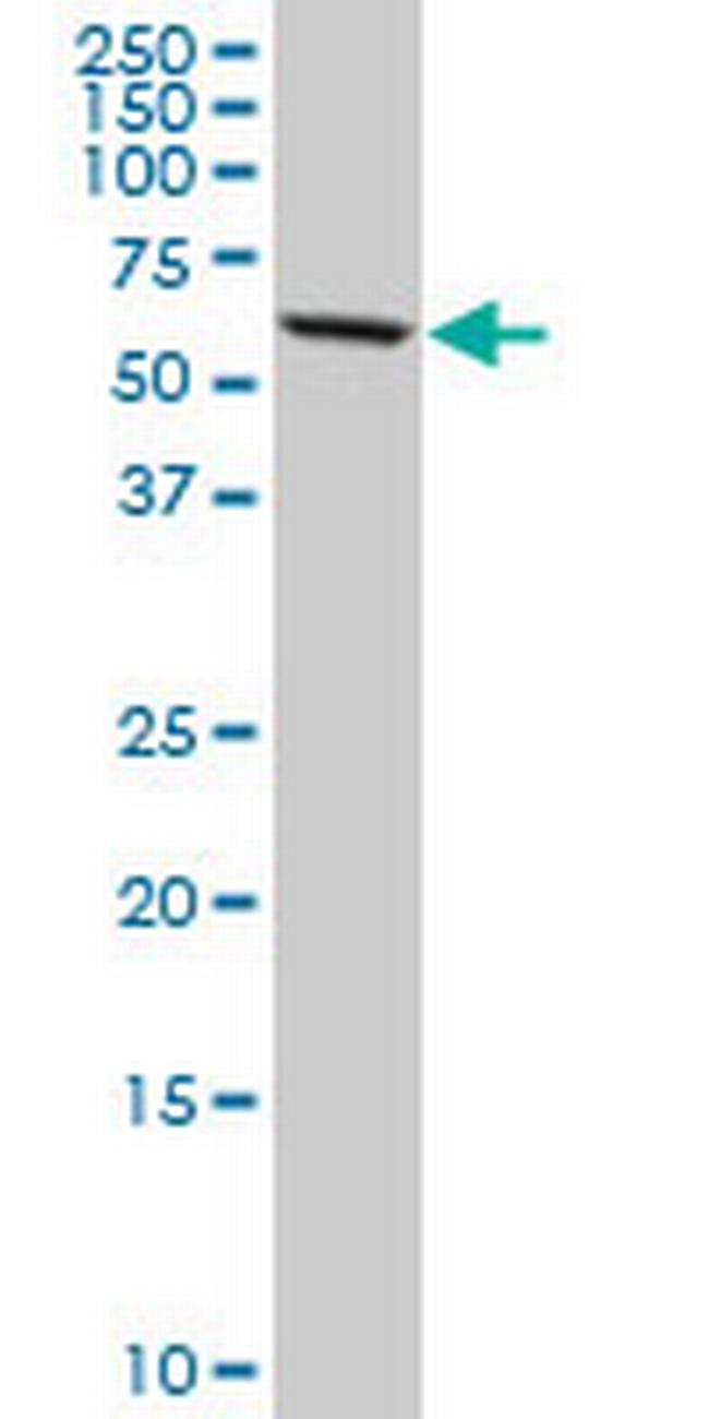 DDX56 Antibody in Western Blot (WB)