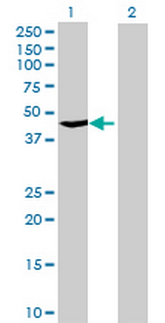 TBC1D13 Antibody in Western Blot (WB)