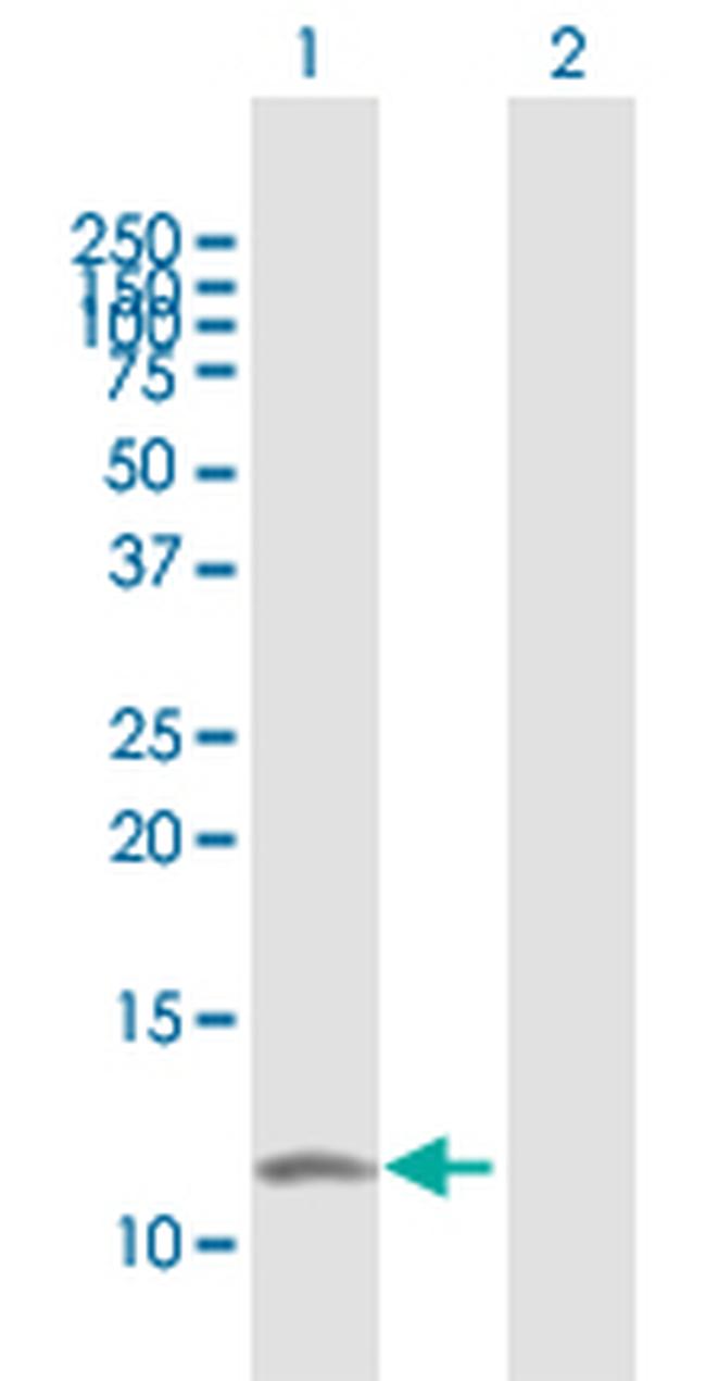 RRN3 Antibody in Western Blot (WB)