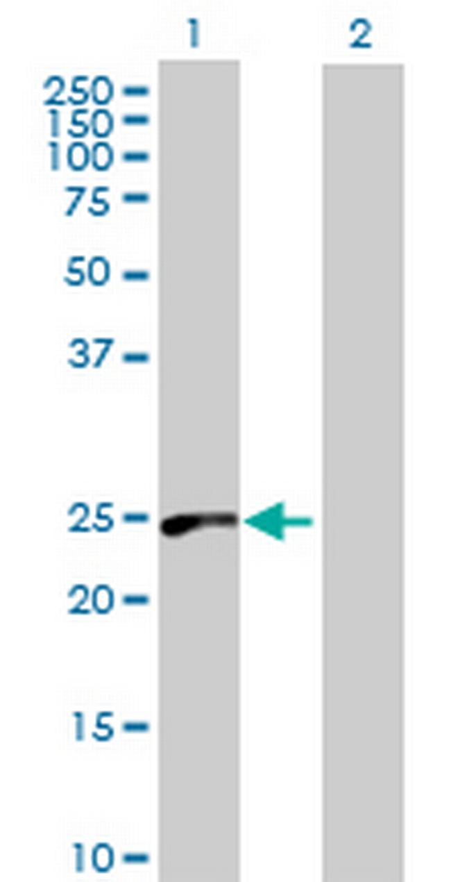 RAB39 Antibody in Western Blot (WB)