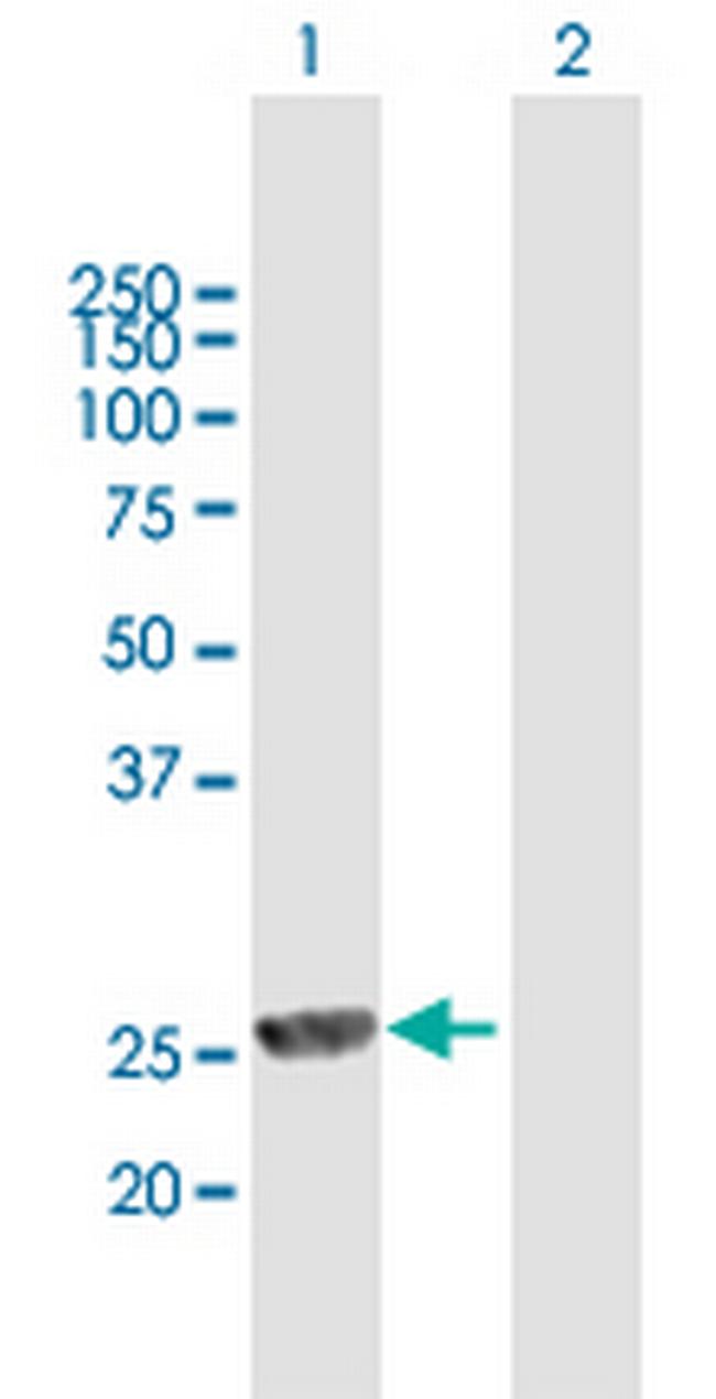 MPHOSPH8 Antibody in Western Blot (WB)