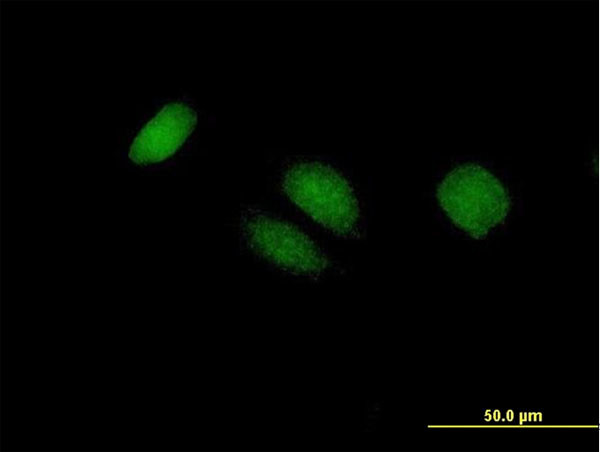 BTG4 Antibody in Immunocytochemistry (ICC/IF)