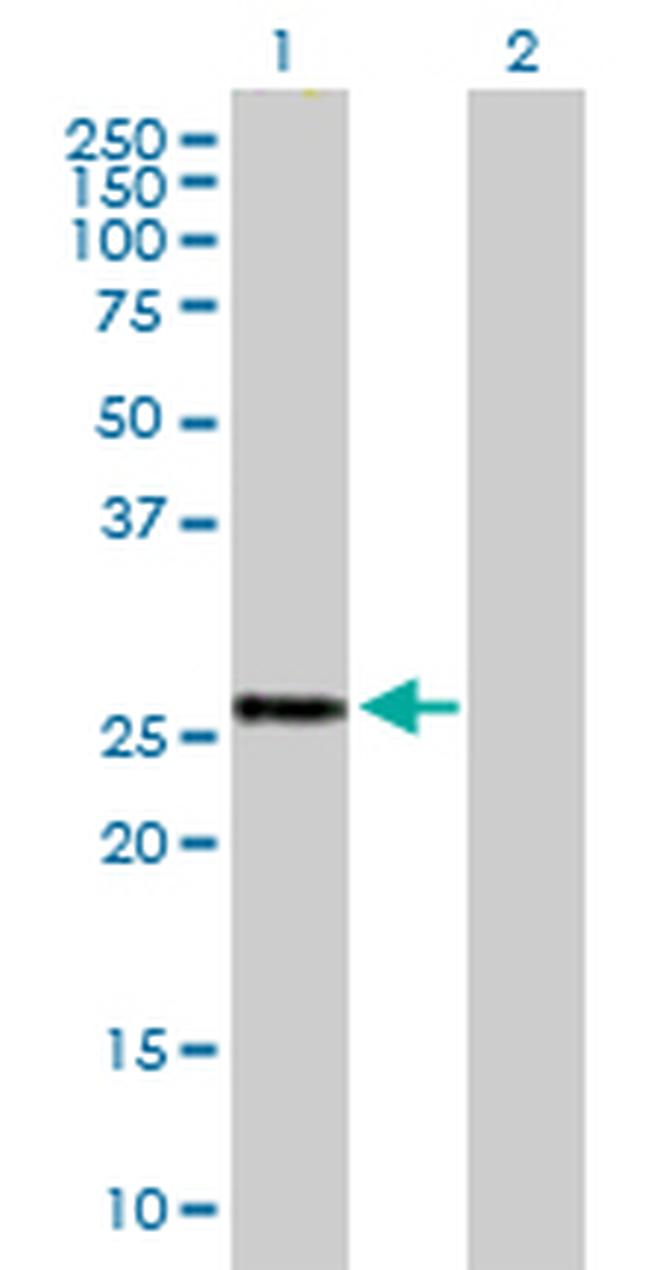 BTG4 Antibody in Western Blot (WB)