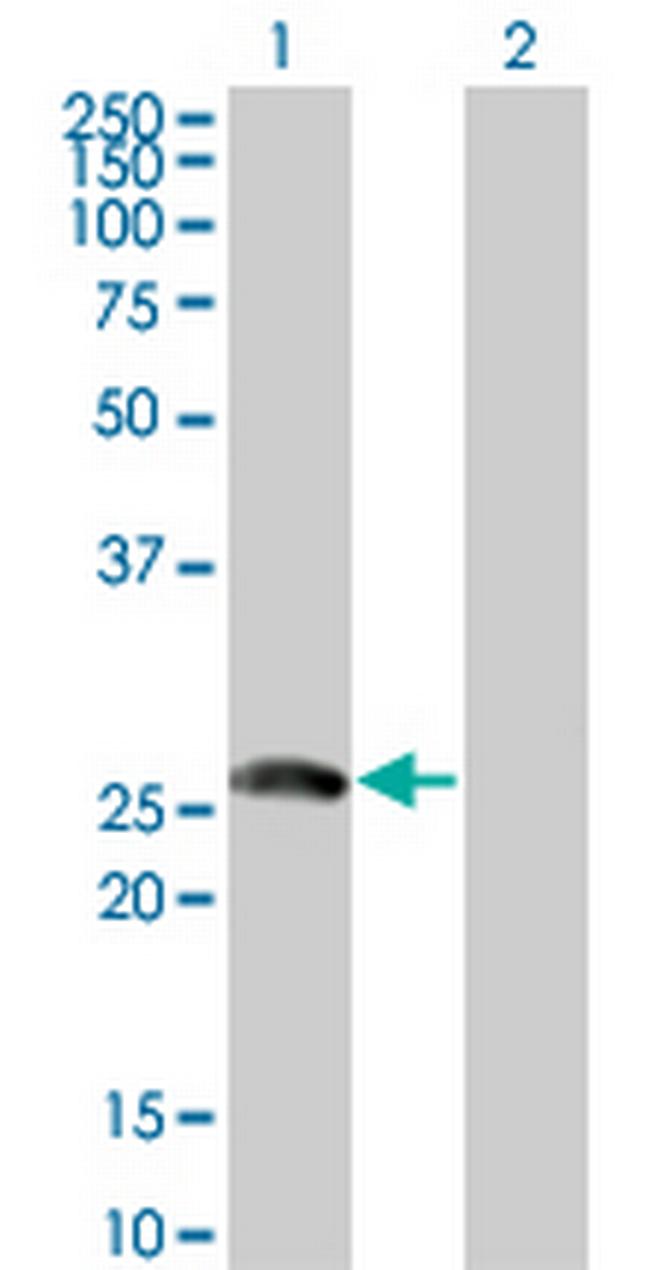 BTG4 Antibody in Western Blot (WB)