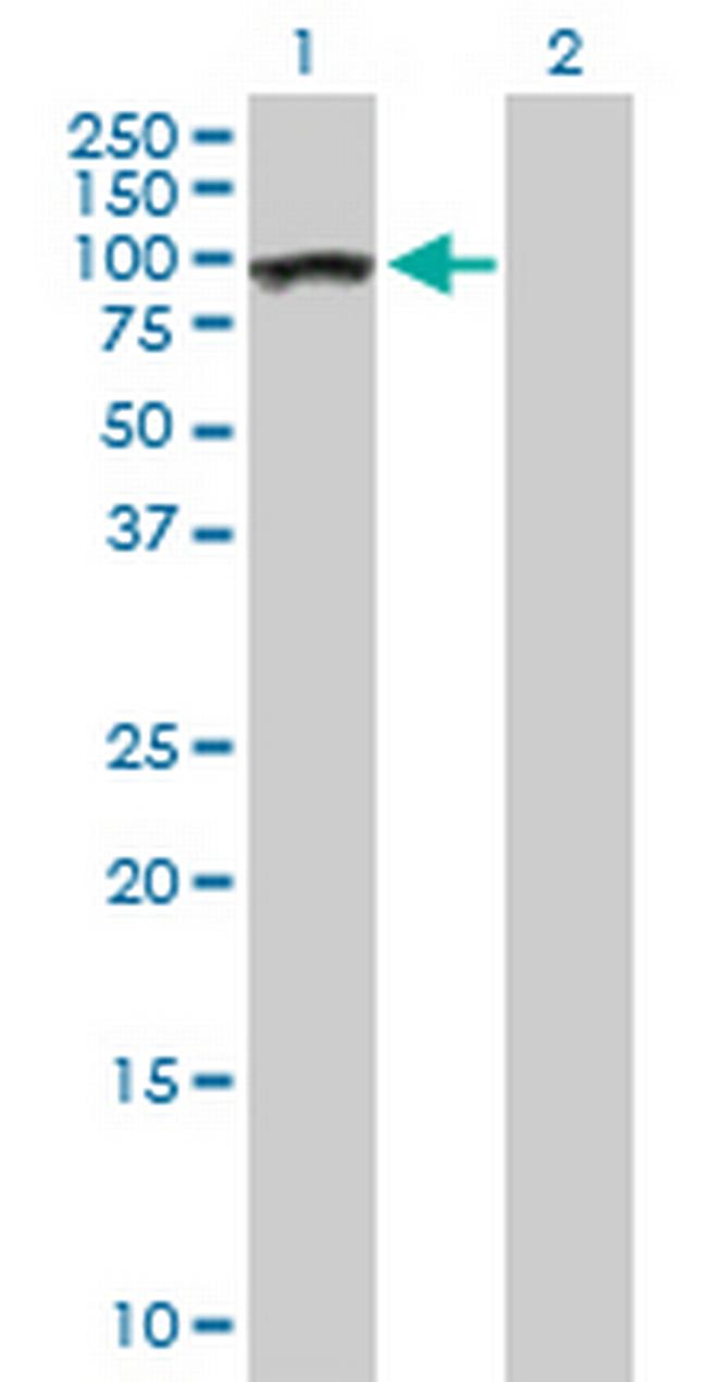 AHI1 Antibody in Western Blot (WB)