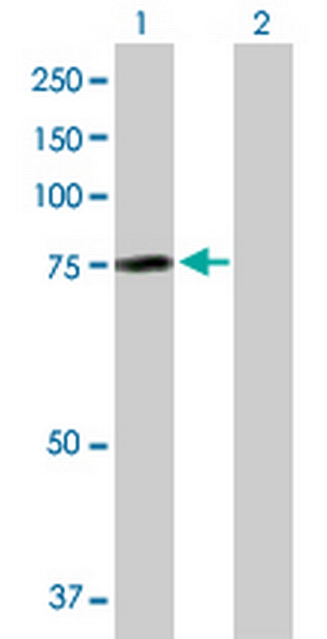 AHI1 Antibody in Western Blot (WB)