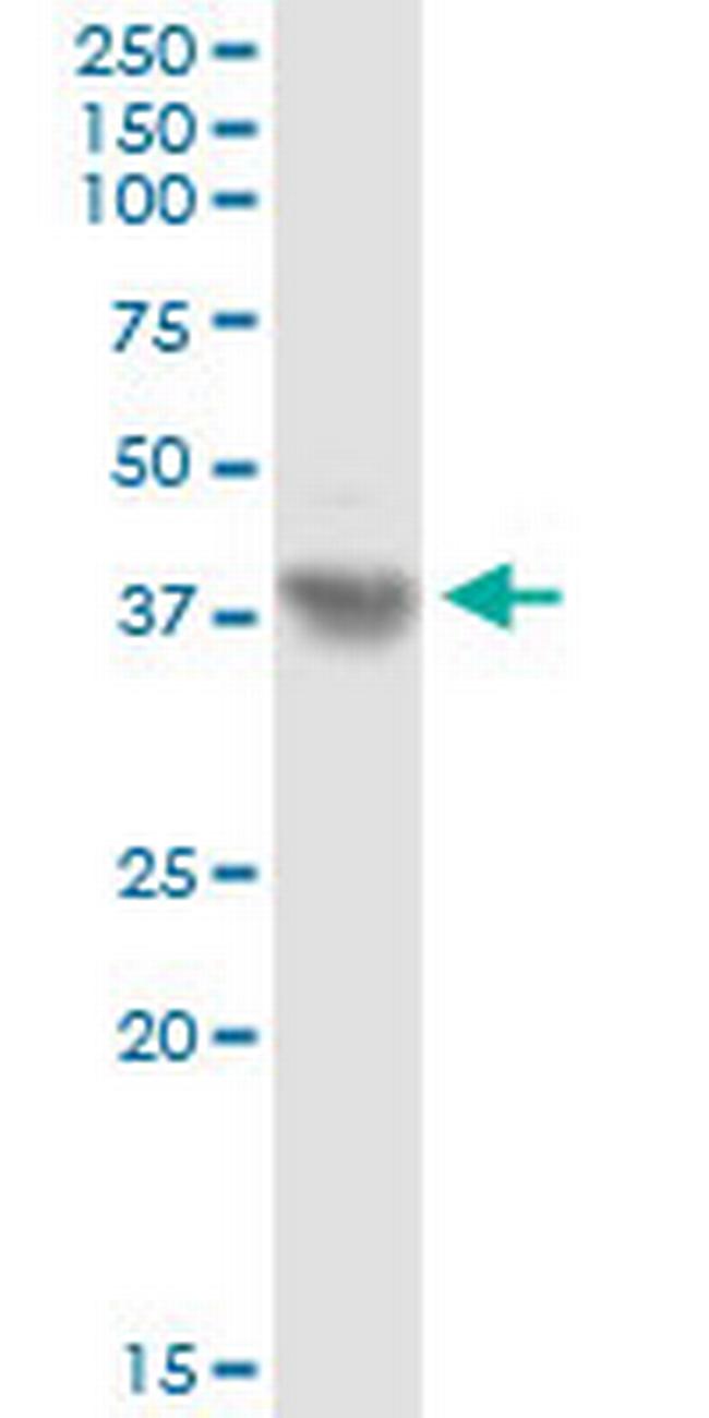 ASPN Antibody in Western Blot (WB)