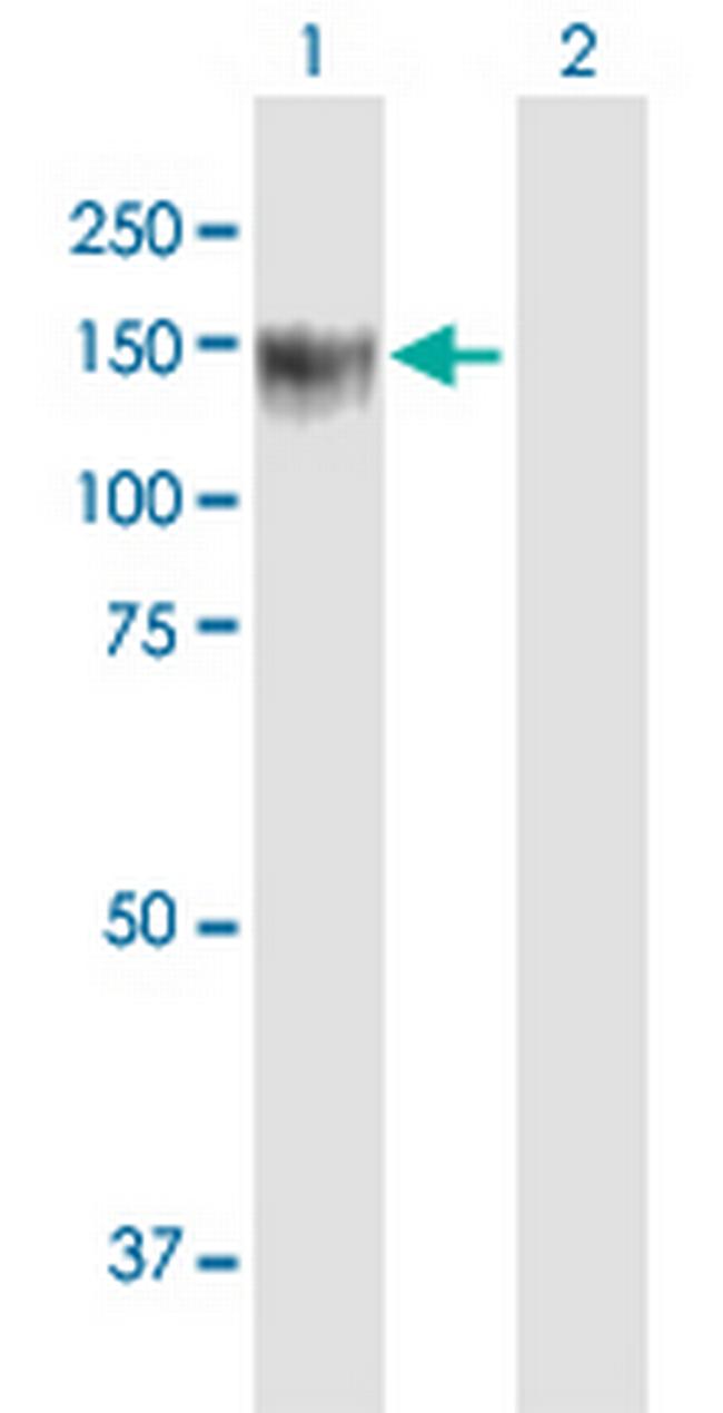 BCOR Antibody in Western Blot (WB)