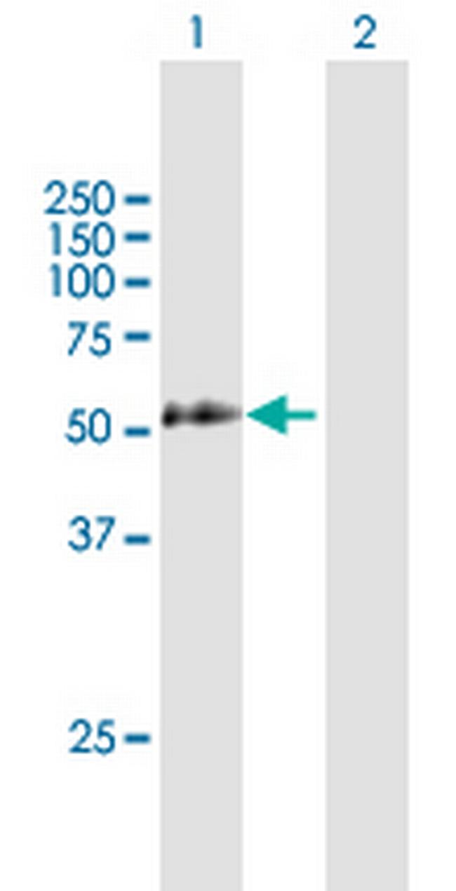 LAX1 Antibody in Western Blot (WB)