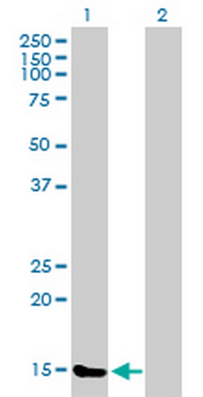 TXNL4B Antibody in Western Blot (WB)