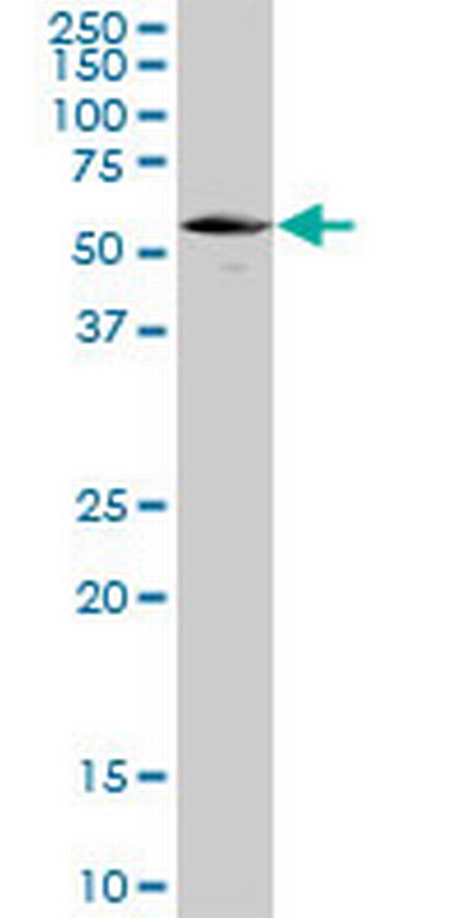 UCKL1 Antibody in Western Blot (WB)