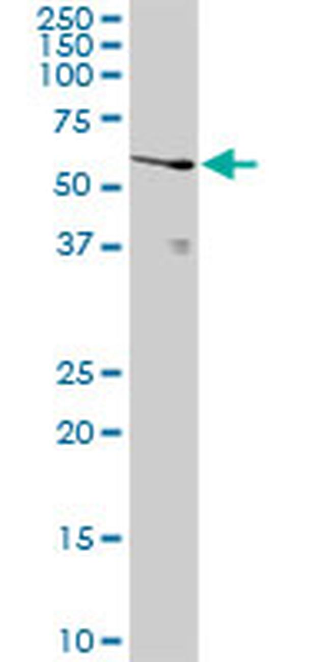 UCKL1 Antibody in Western Blot (WB)