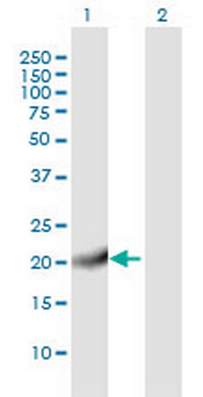 C20orf27 Antibody in Western Blot (WB)