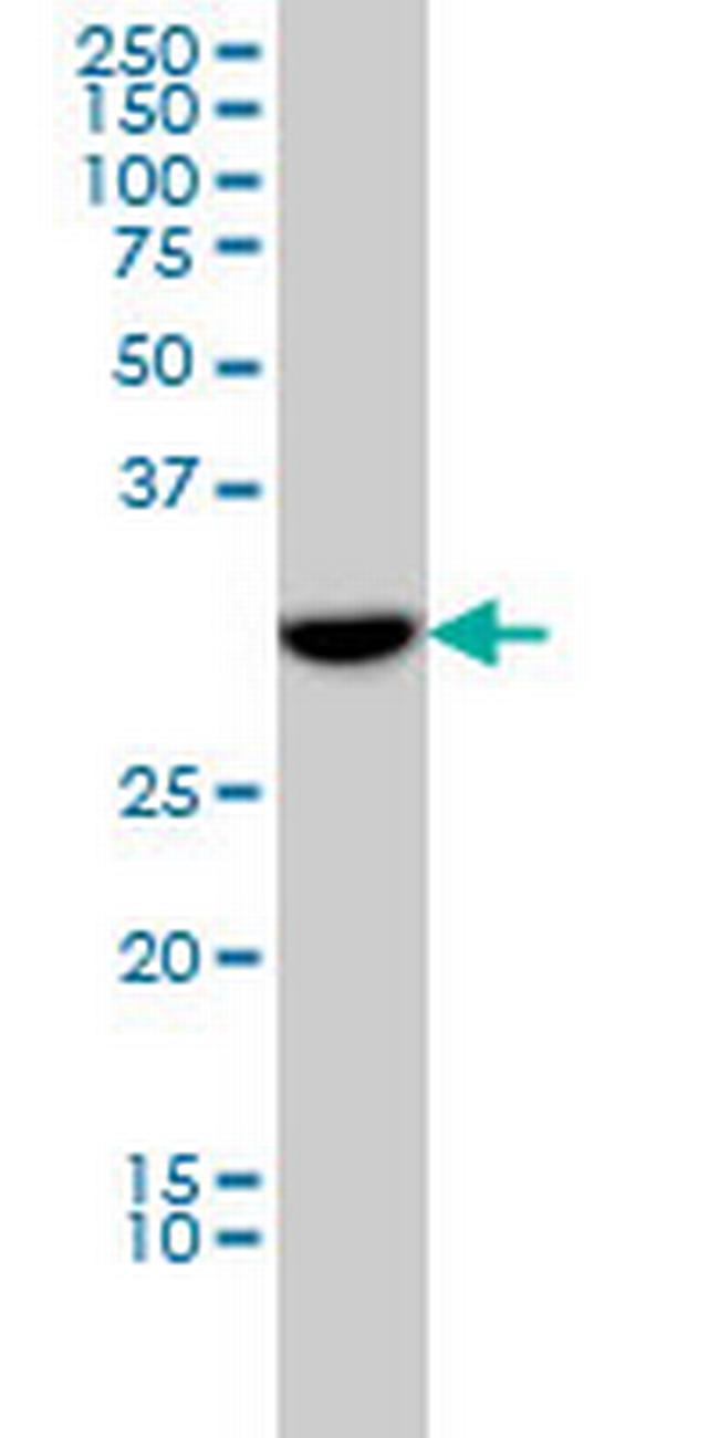 FLJ20643 Antibody in Western Blot (WB)