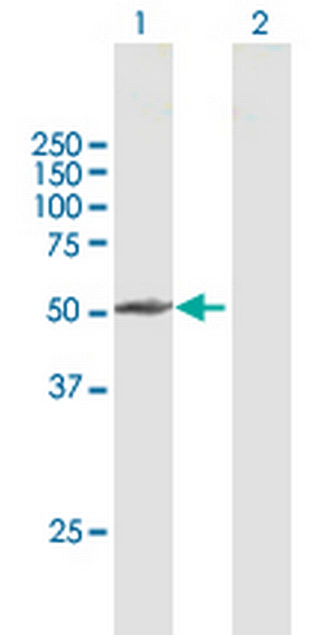 PPP2R3C Antibody in Western Blot (WB)